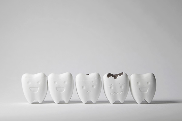 How a General Dentist Can Treat Tooth Decay from Hermann Park Smiles in Houston, TX