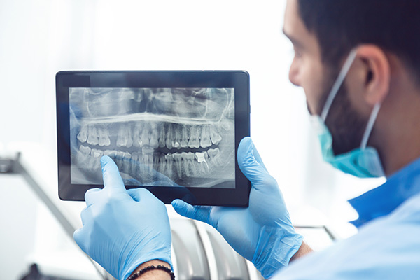 General Dentistry: Are Dental X-rays Recommended? from Hermann Park Smiles in Houston, TX