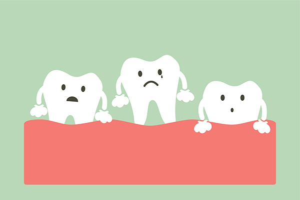 General Dentistry: How to Treat a Loose Tooth from Hermann Park Smiles in Houston, TX