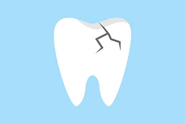 General Dentistry Treatments for a Damaged Tooth from Hermann Park Smiles in Houston, TX