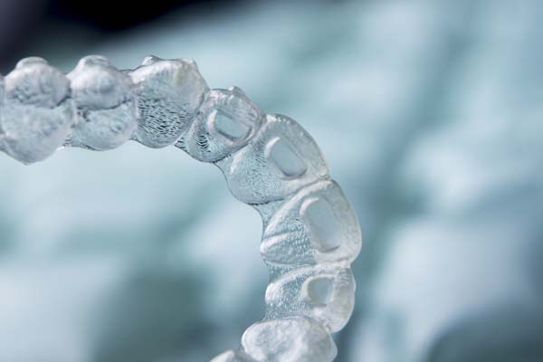 Reasons To Pick Invisalign Over Metal Braces